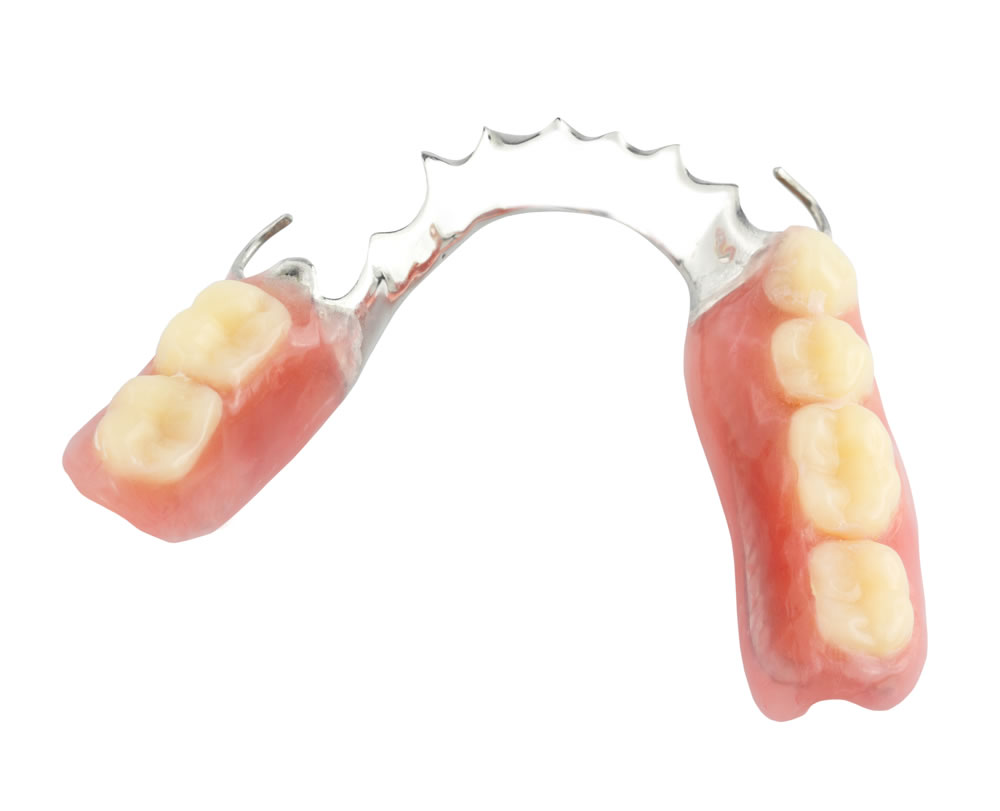partial dentures1